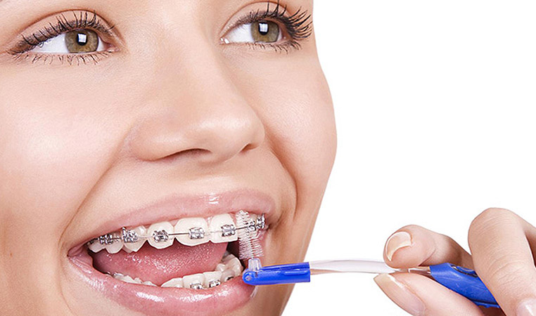 Ortodoncia en la Clinica dental dentista de Burgos